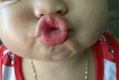 Meme Hôn – Ảnh Chế Kiss Hành Động Hôn Cute Romantic 💋
