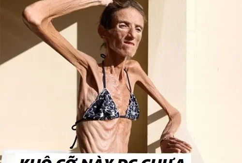 Vắt Cực Khô Meme – Ảnh Chế Tận Dụng Triệt Để Hài 🍋
